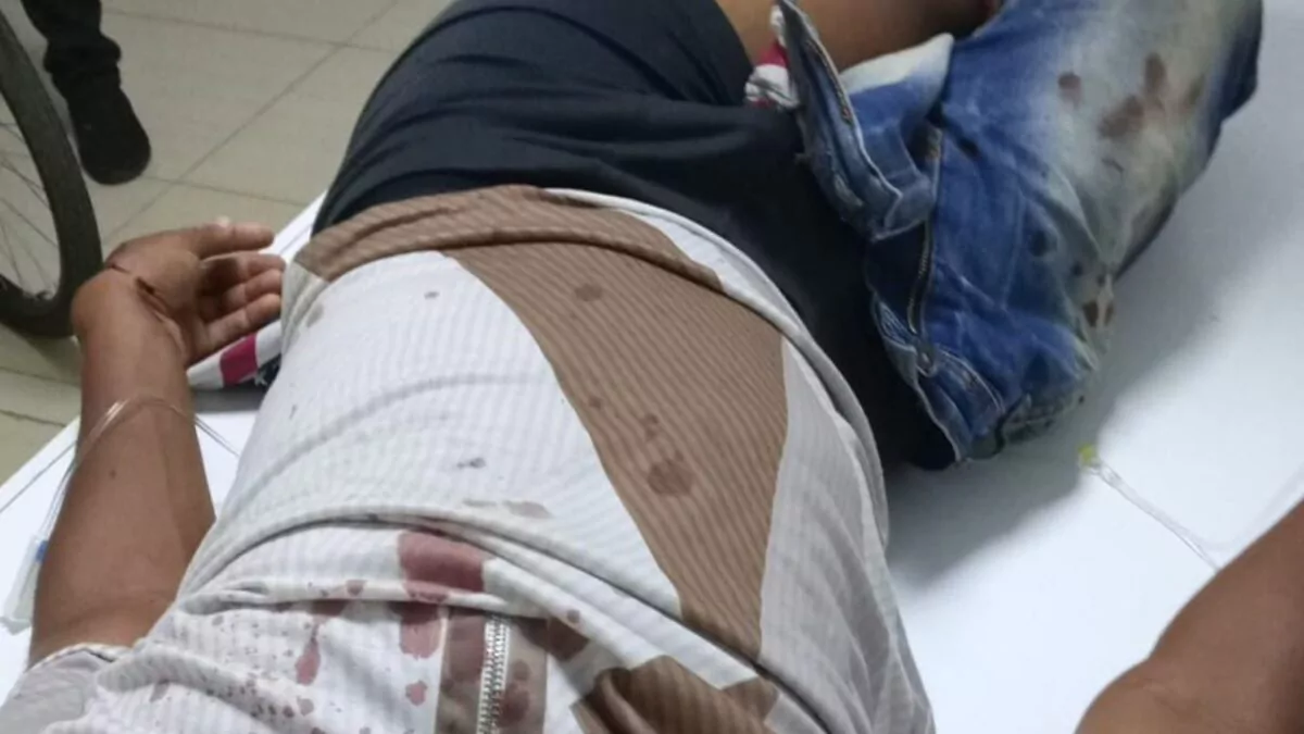 buscan-conductor-que-atropello-a-menor-y-huyo-tras-accidente-en-via-publica