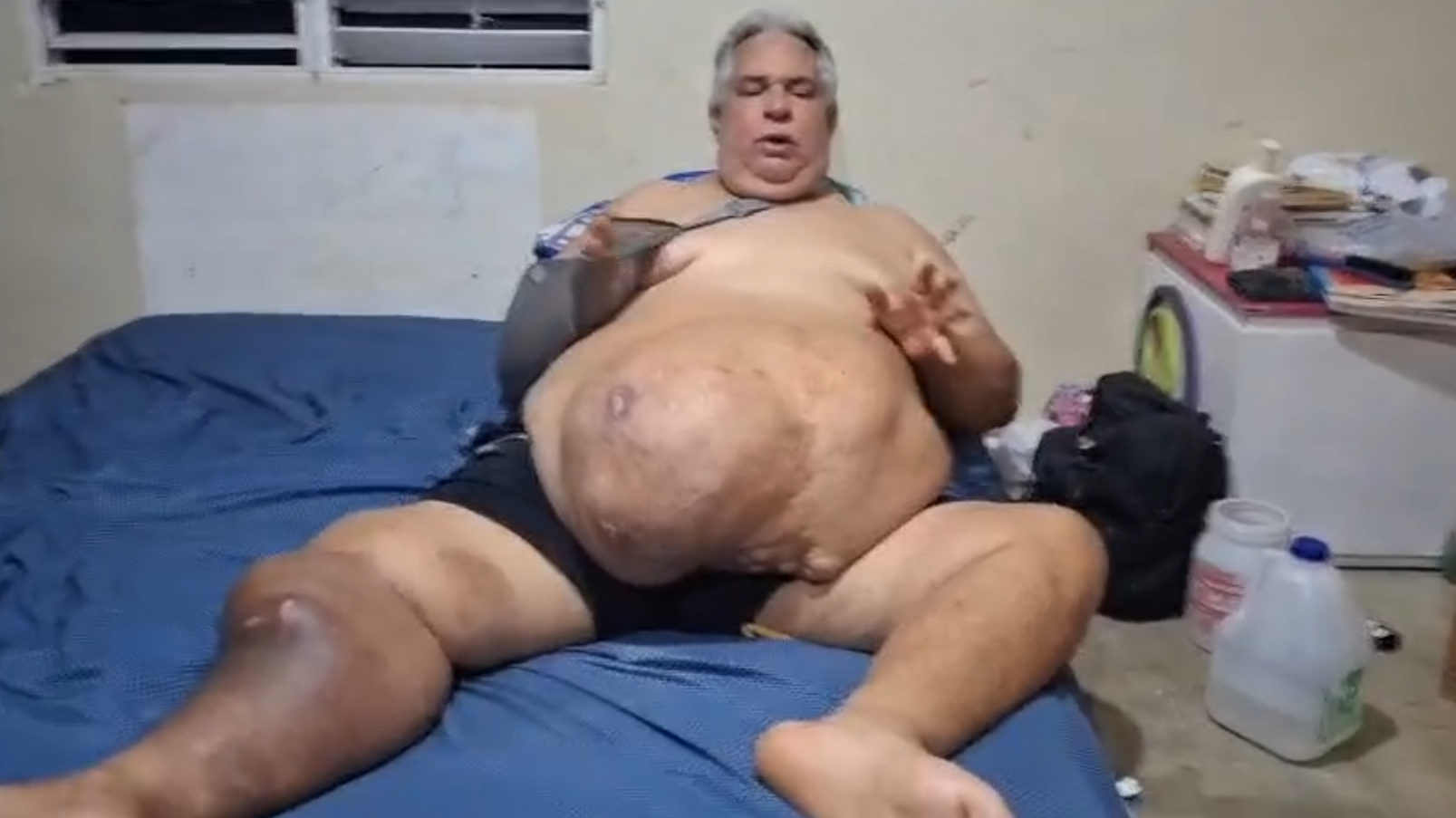 hombre-que-lleva-11-anos-postrado-pide-ayuda-para-operarse-de-tumor